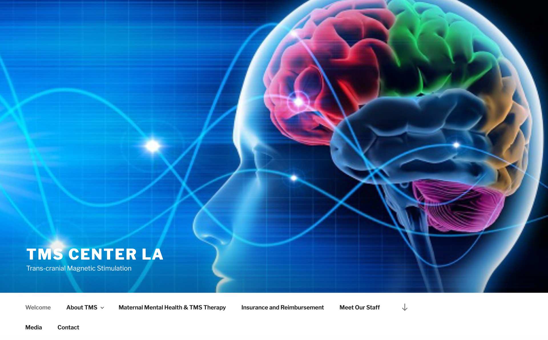 A computer generated image of a human brain with the words tms center la on the bottom