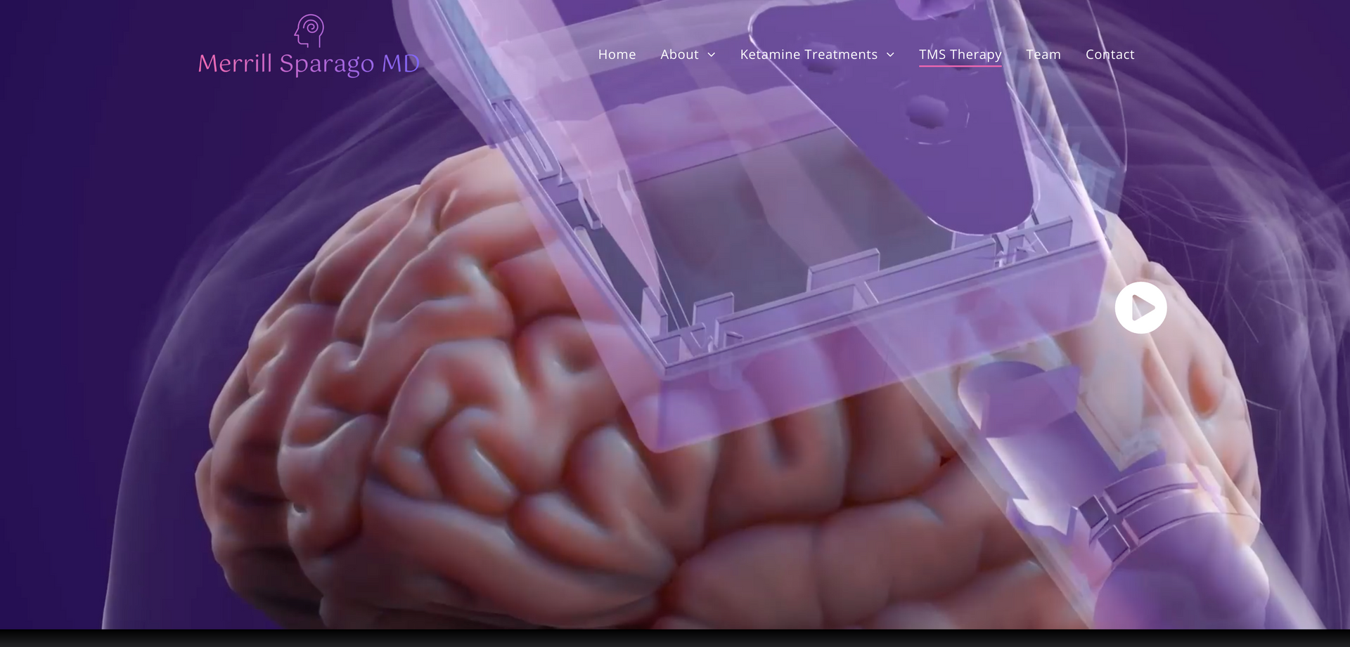 A computer generated image of a person 's brain