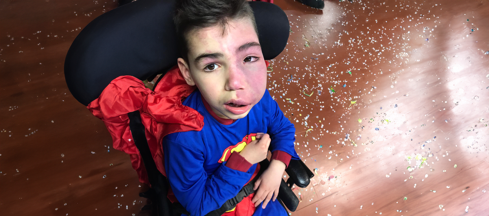Un ragazzino con la sindrome di Sturge Weber è seduto su una sedia a rotelle vestito da Superman.