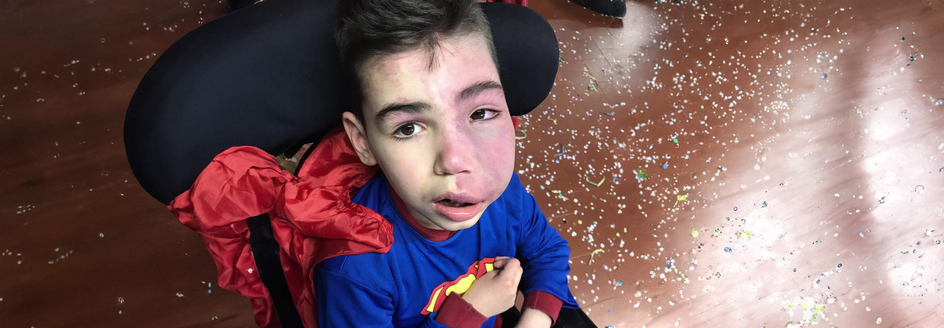 Un ragazzino con la sindrome di Sturge-Weber è seduto su una sedia a rotelle e indossa un costume da Superman.