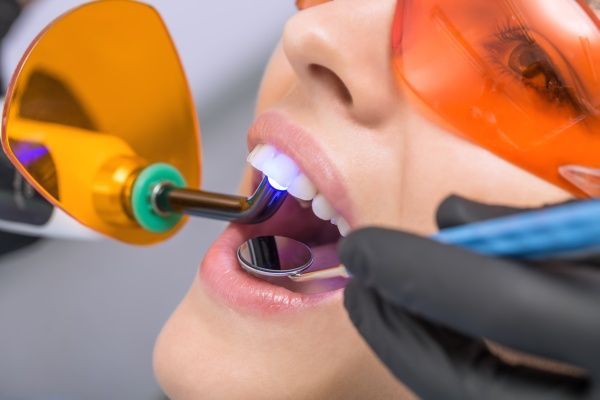 Lazerinė odontologija Lazerinė odontologija