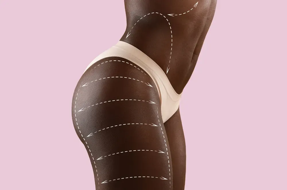 An infographic showing the body's contours lines.