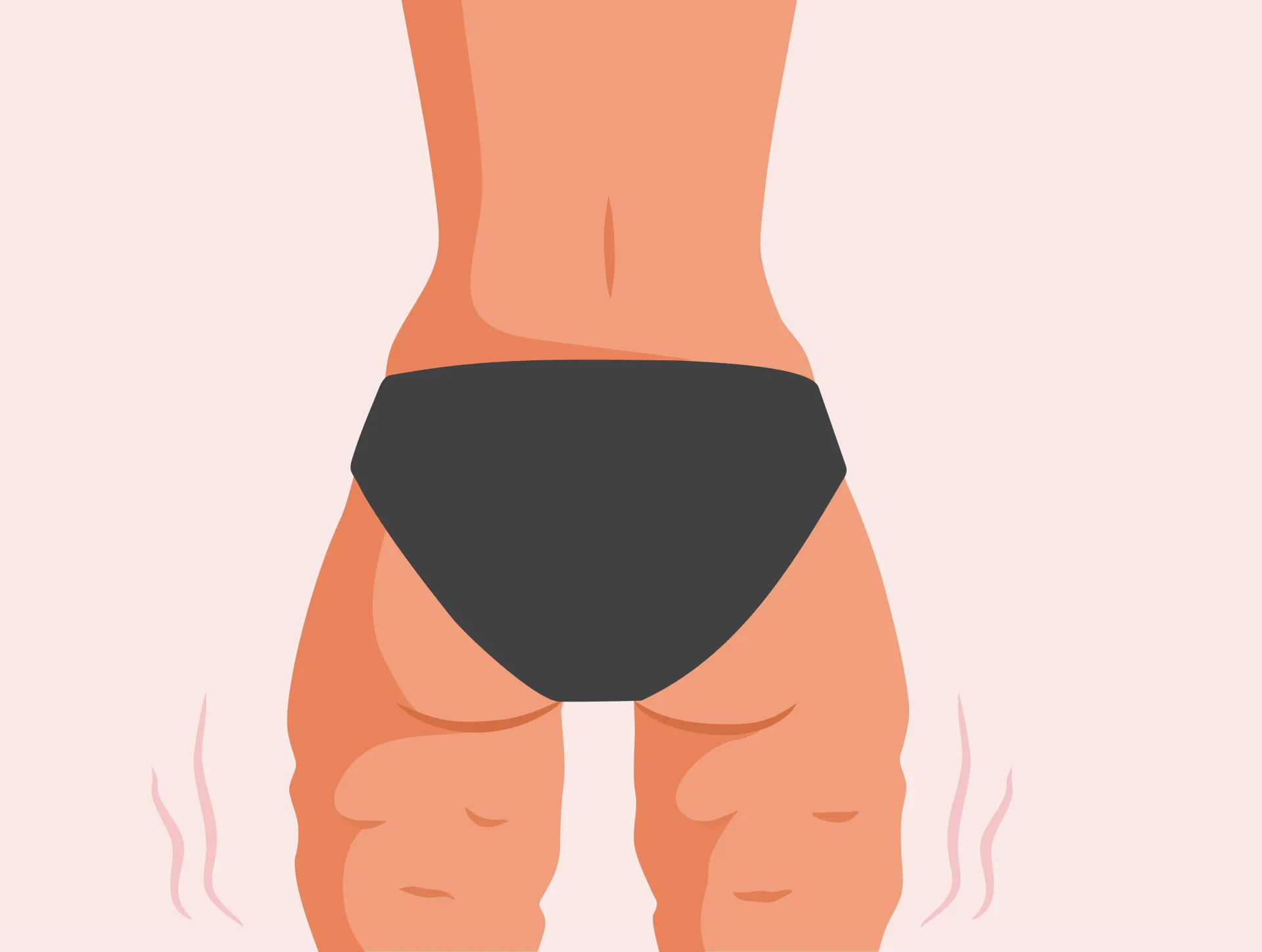 A graphic depicting cellulite.