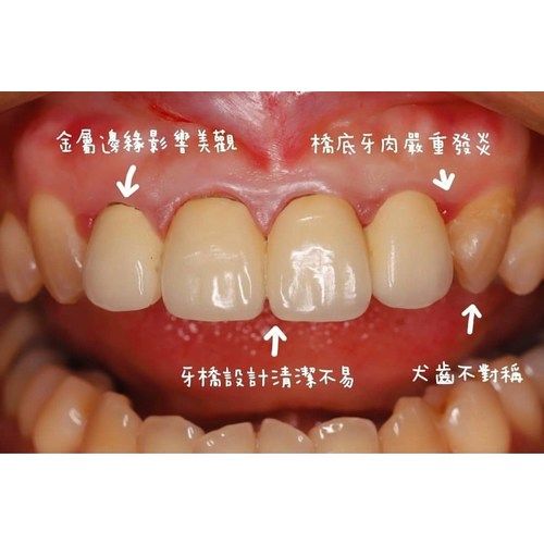 Tooth Case 2