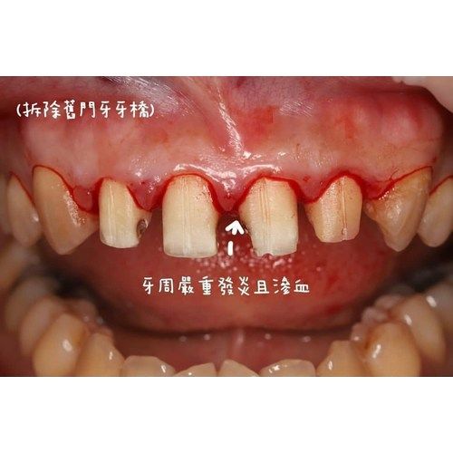Tooth Case 2