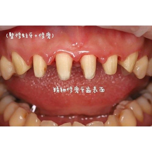 Tooth Case 2