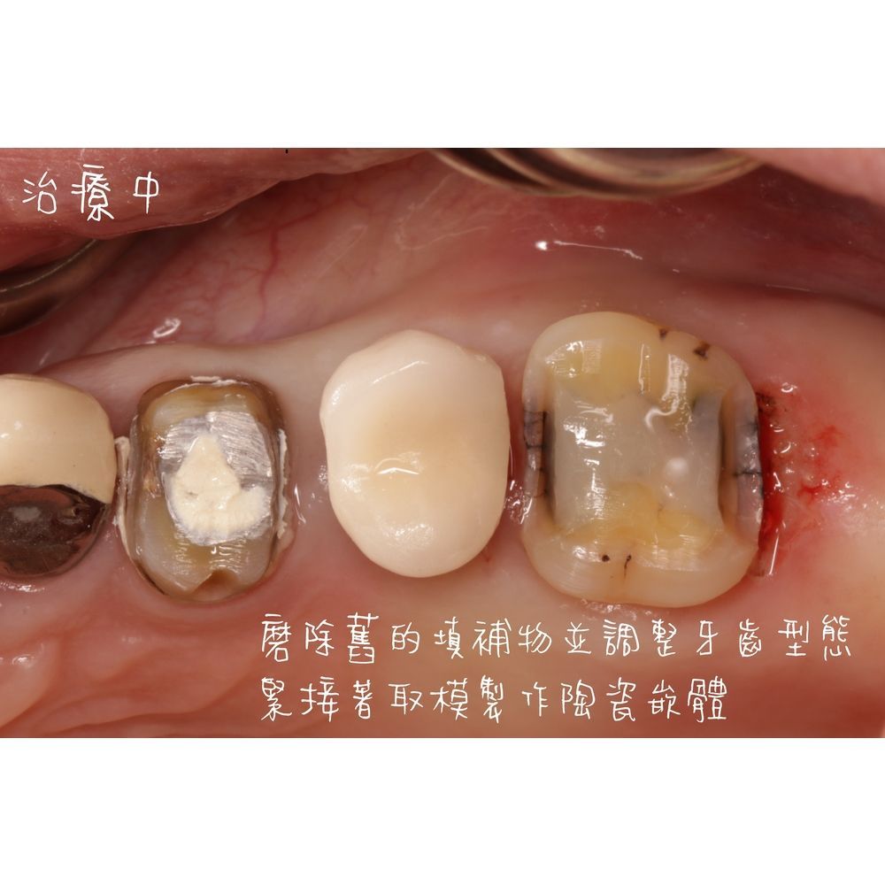 Case 1 - CAD