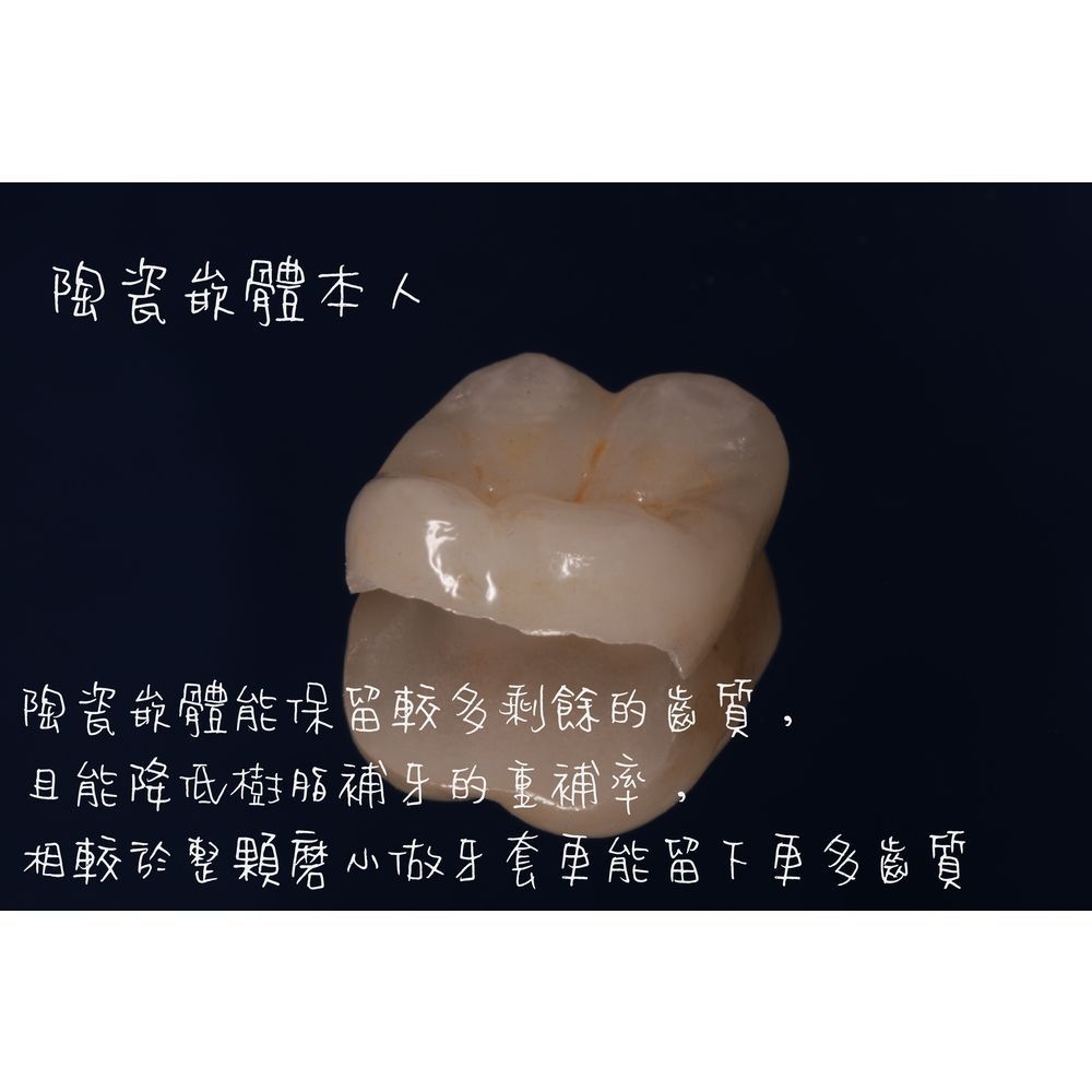Case 1 - CAD