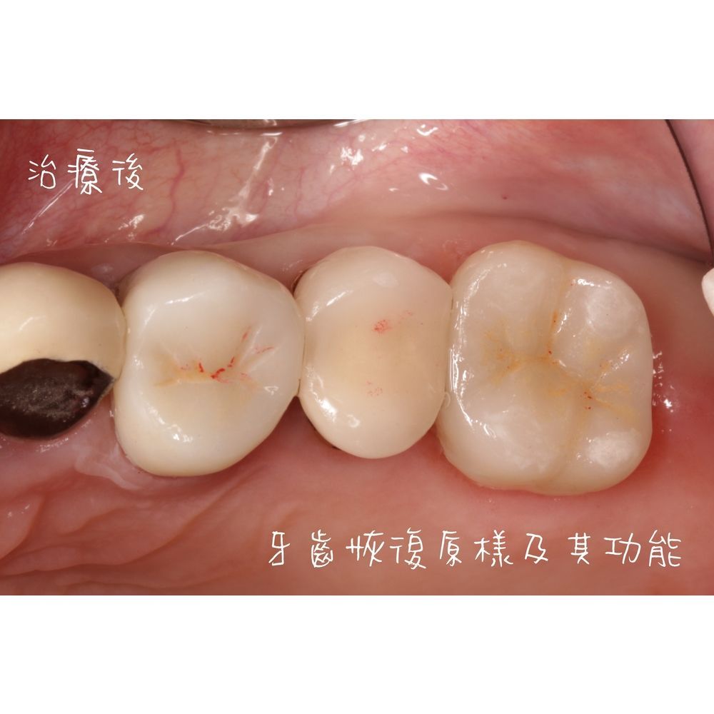 Case 1 - CAD