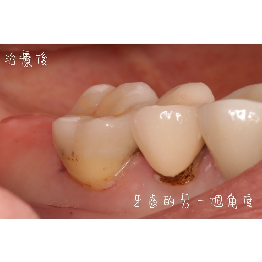 Case 1 - CAD