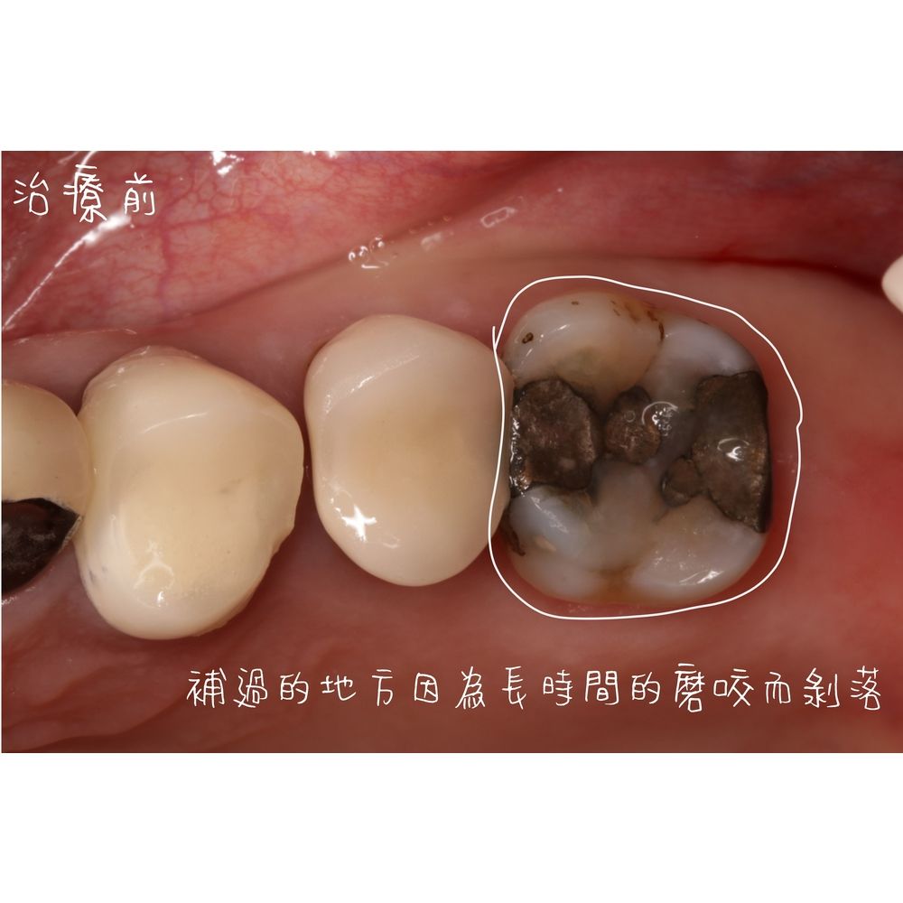 Case 1 - CAD