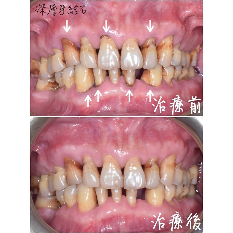 Case 1 Periodontal