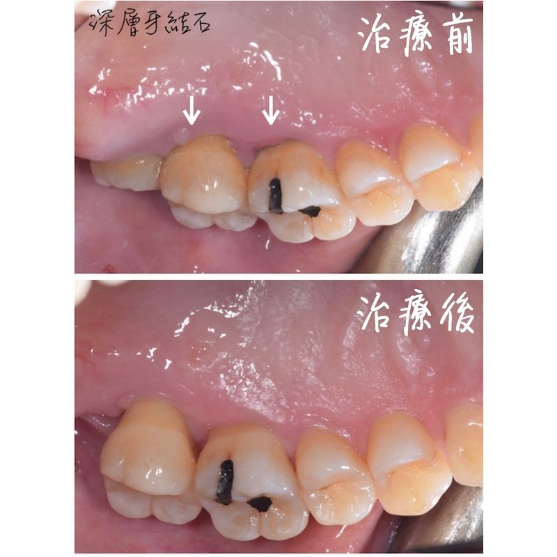 Case 1 Periodontal
