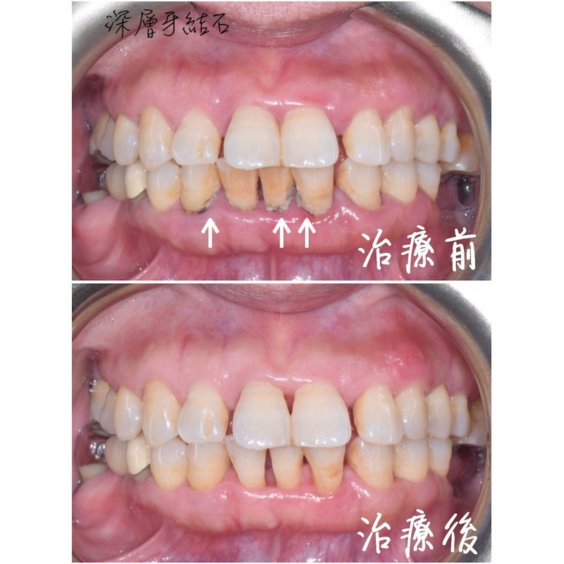 Case 1 Periodontal