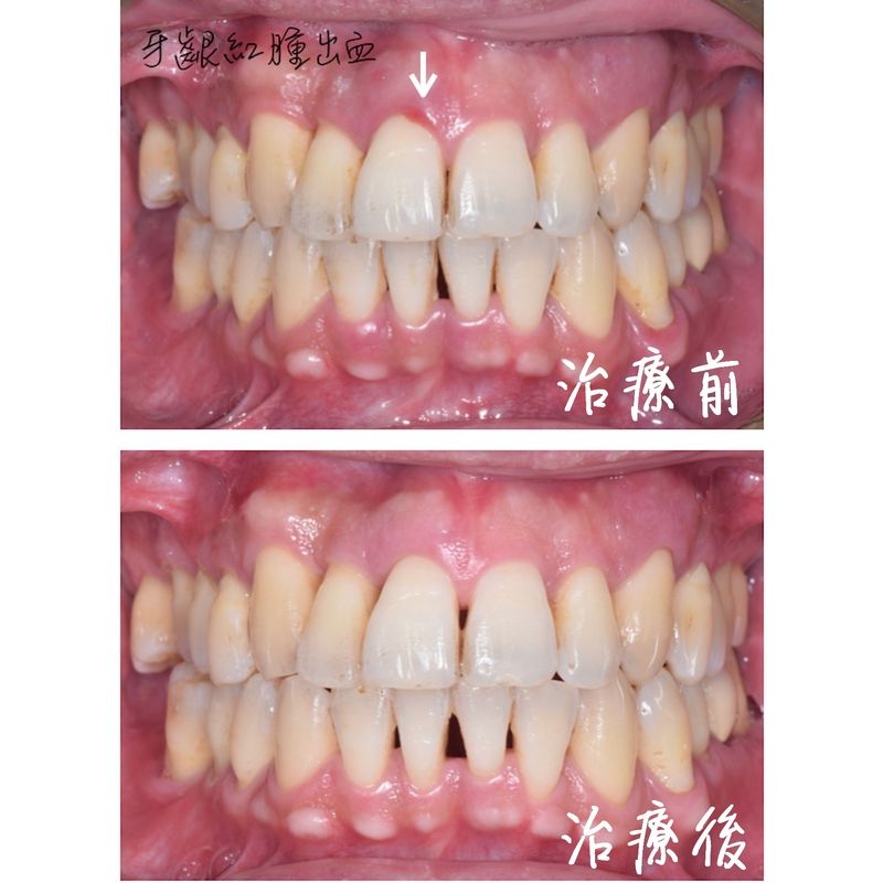 Case 2 Periodontal