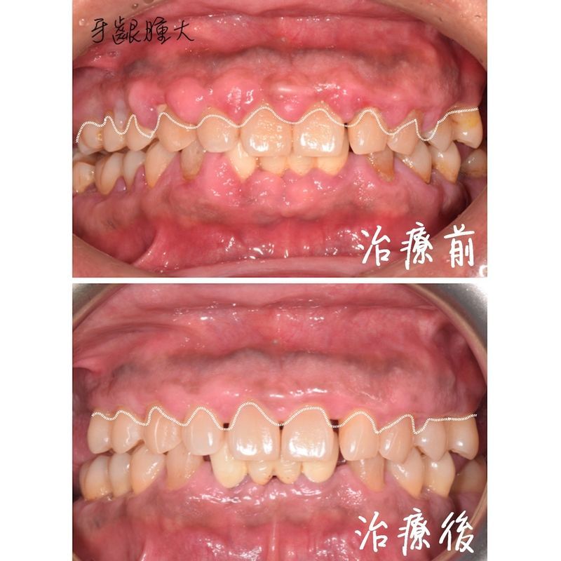 Case 2 Periodontal