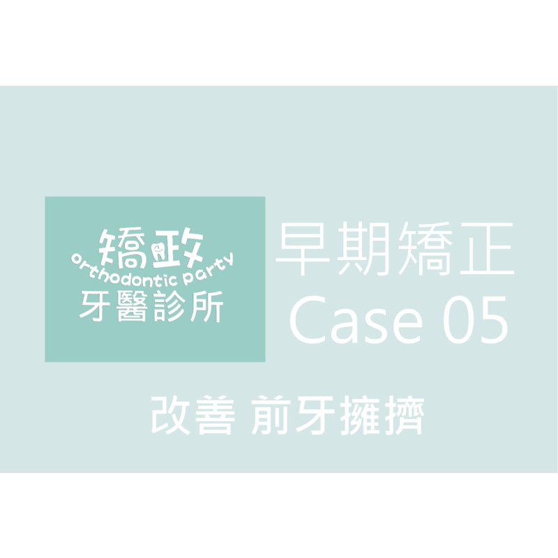 Case Five Invisalign