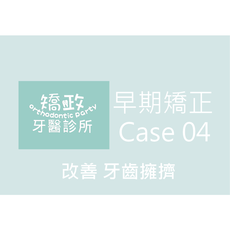 Case Four Invisalign