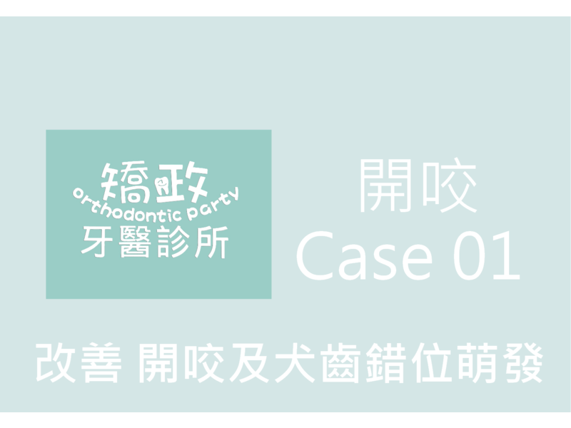 Case One Bite