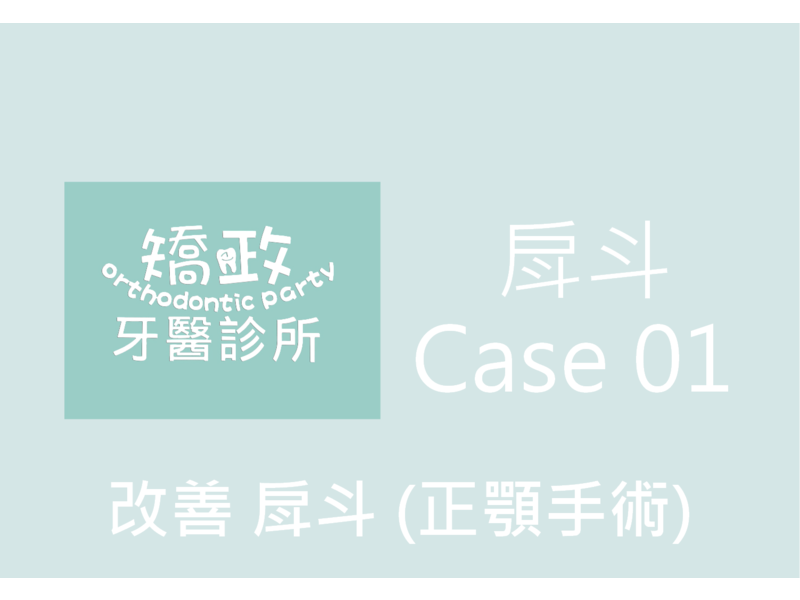Case One Bucket