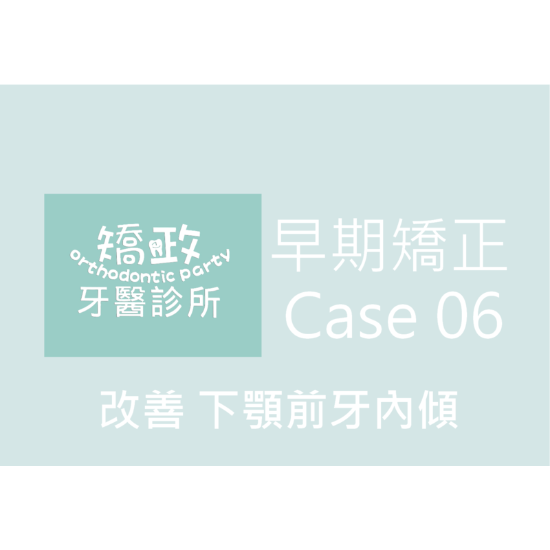Case Six Invisalign