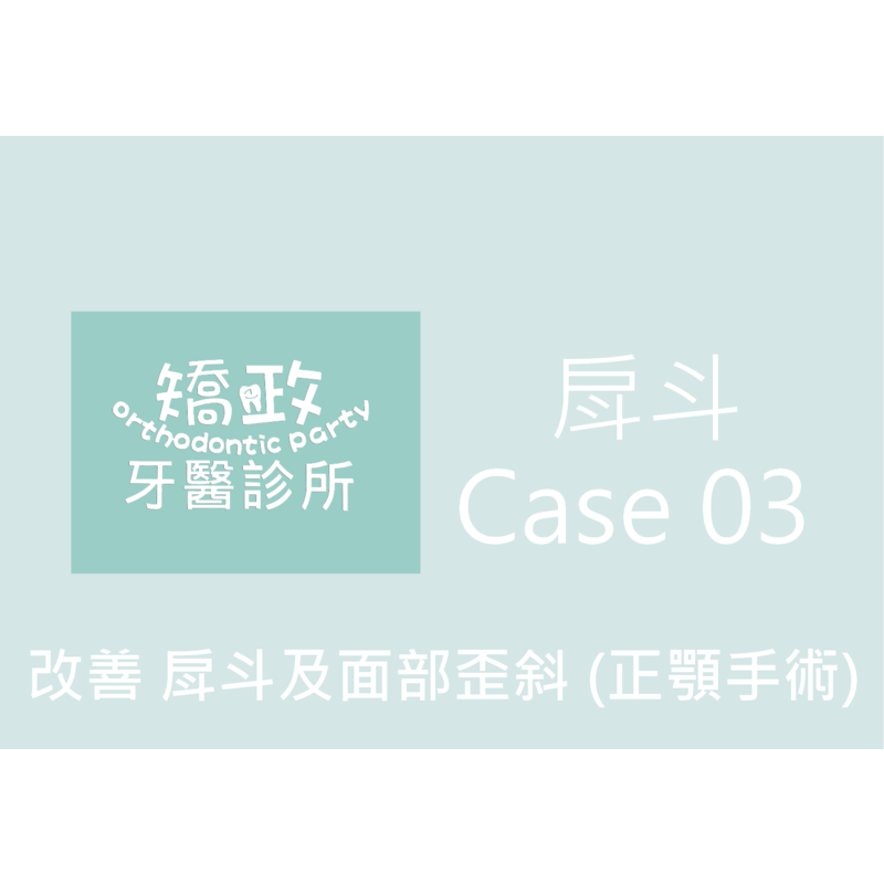 Case Three Bucket