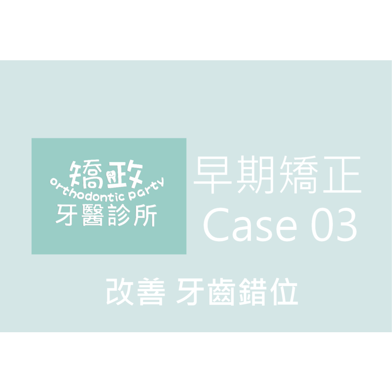 Case Three Invisalign