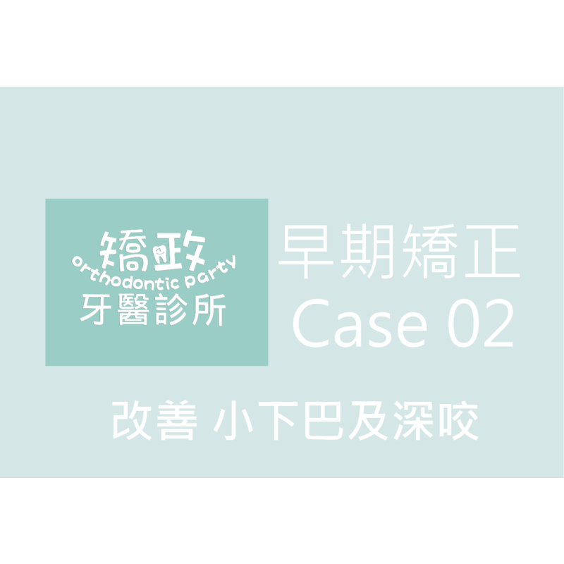 Case Two Invisalign