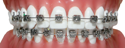 Orthodontics-3