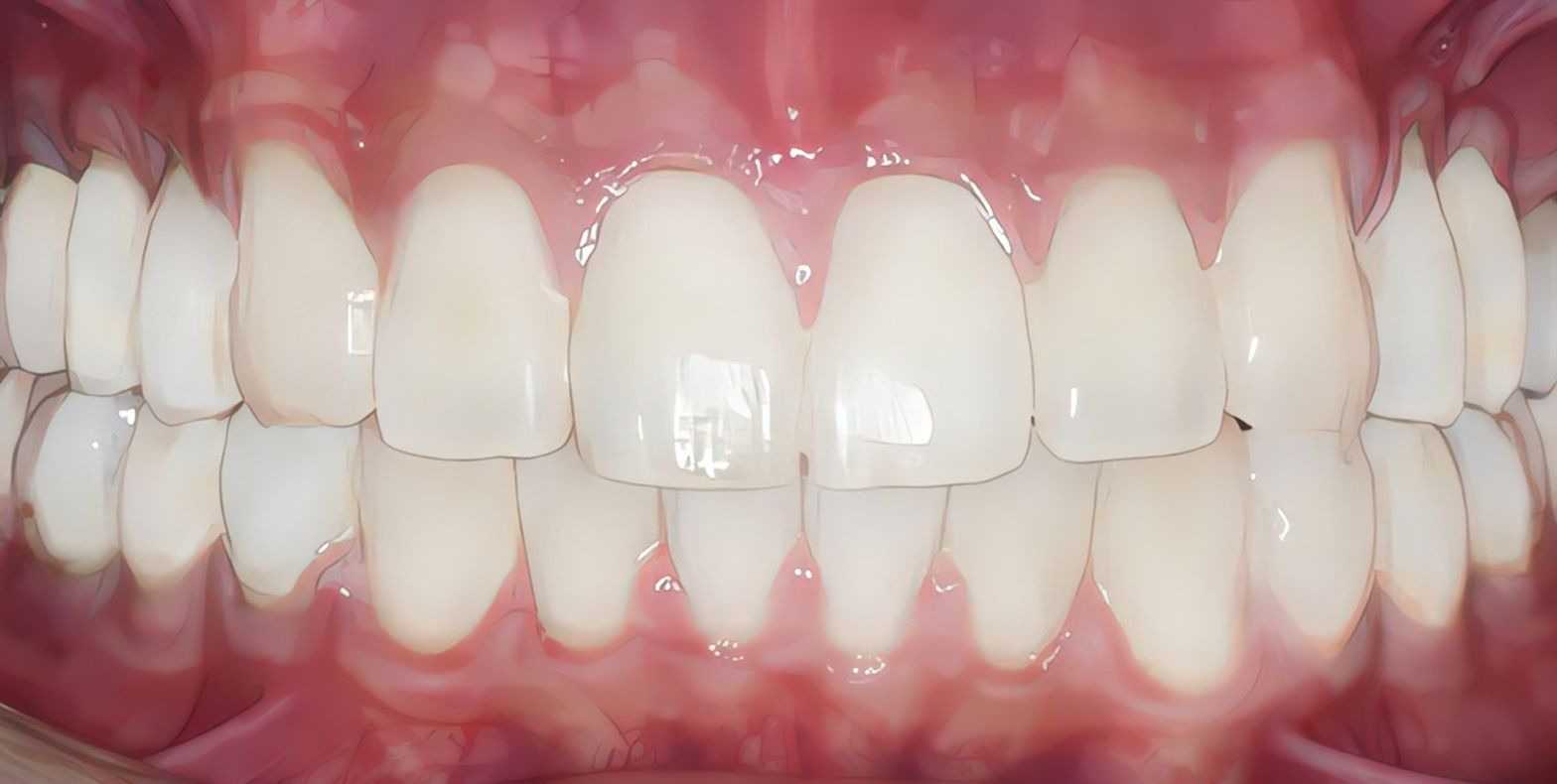 tooth