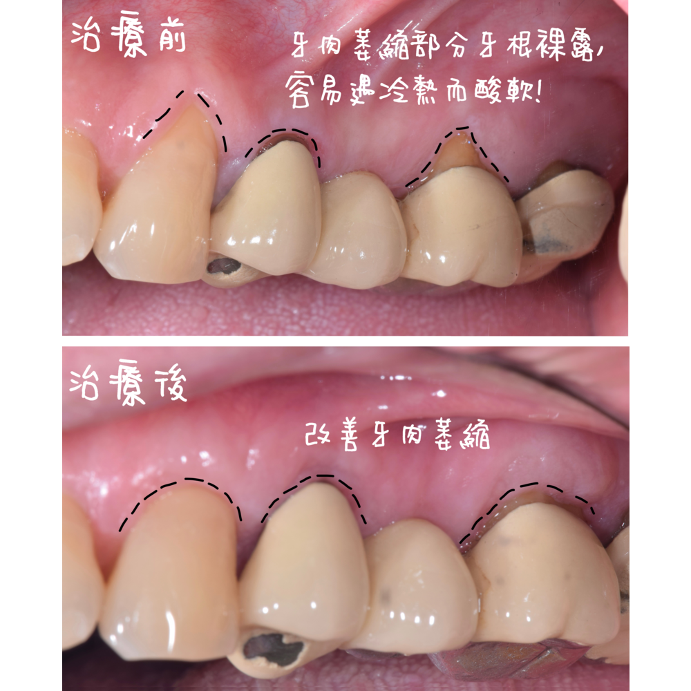 Tooth