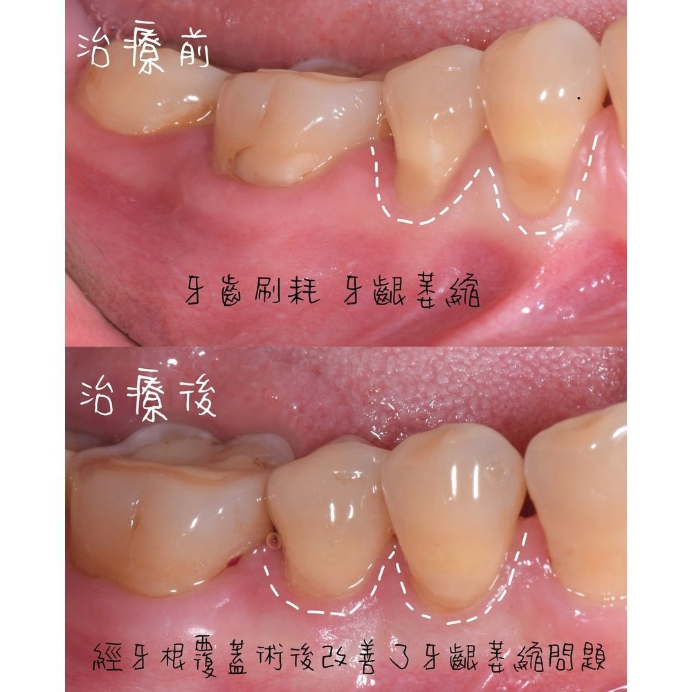 Tooth