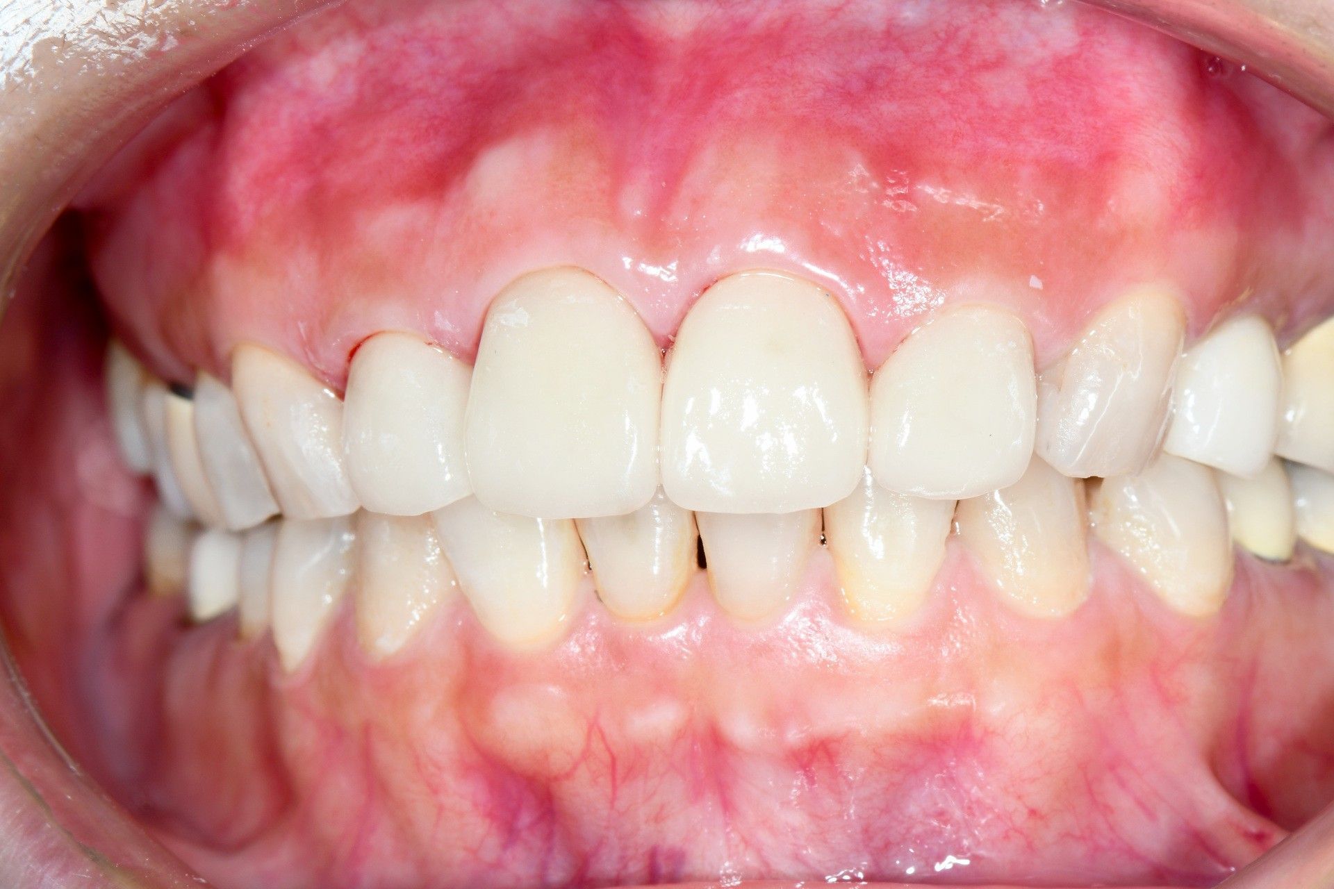 tooth