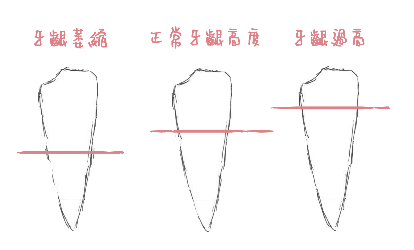 tooth