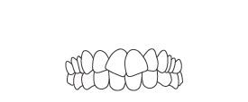 Well-aligned teeth