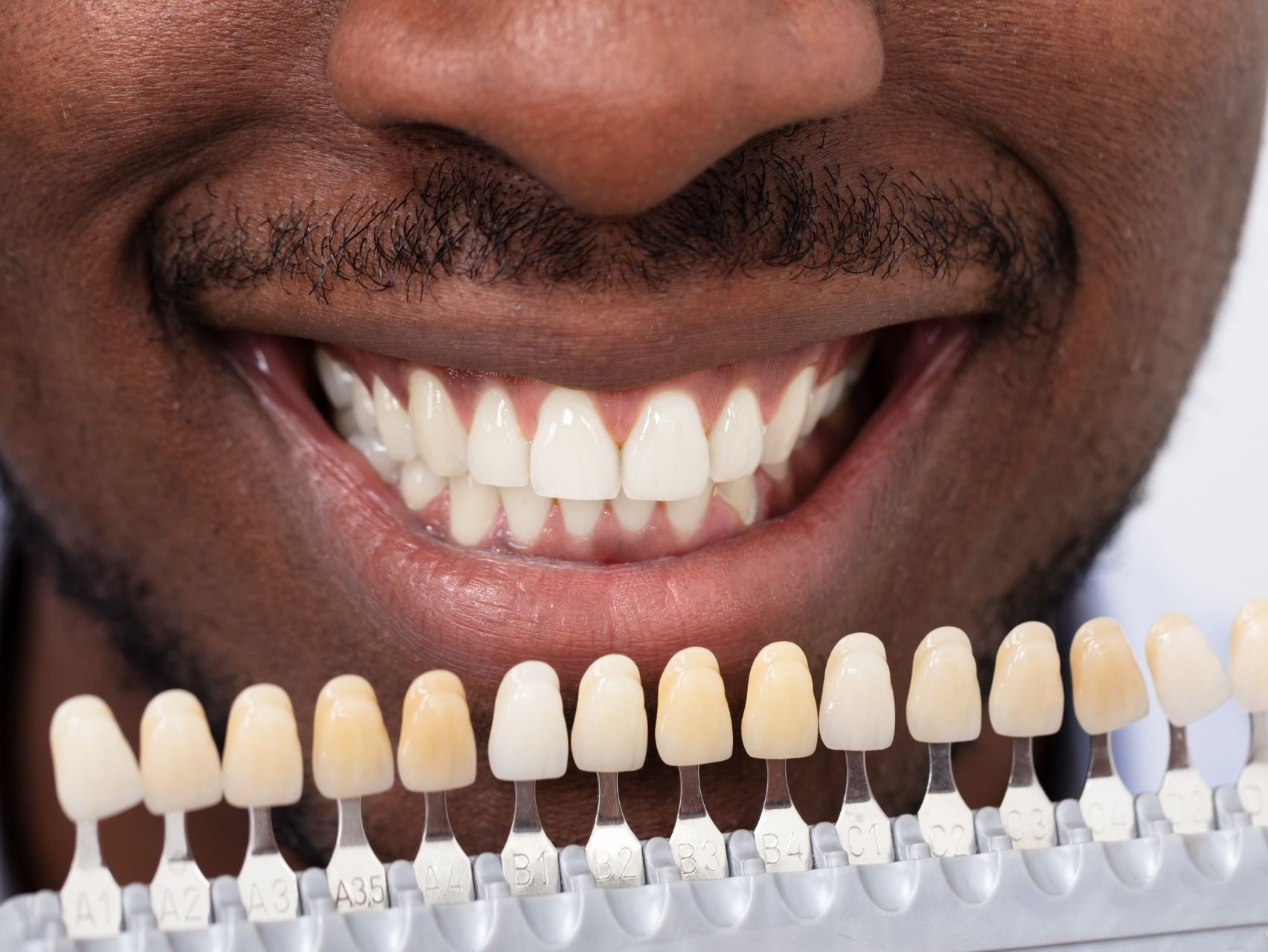 Dentistry Services In Mcloud