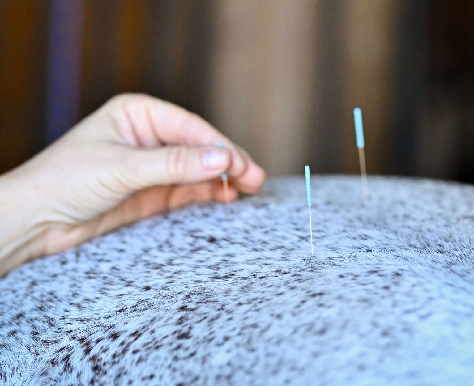 Acupuncture