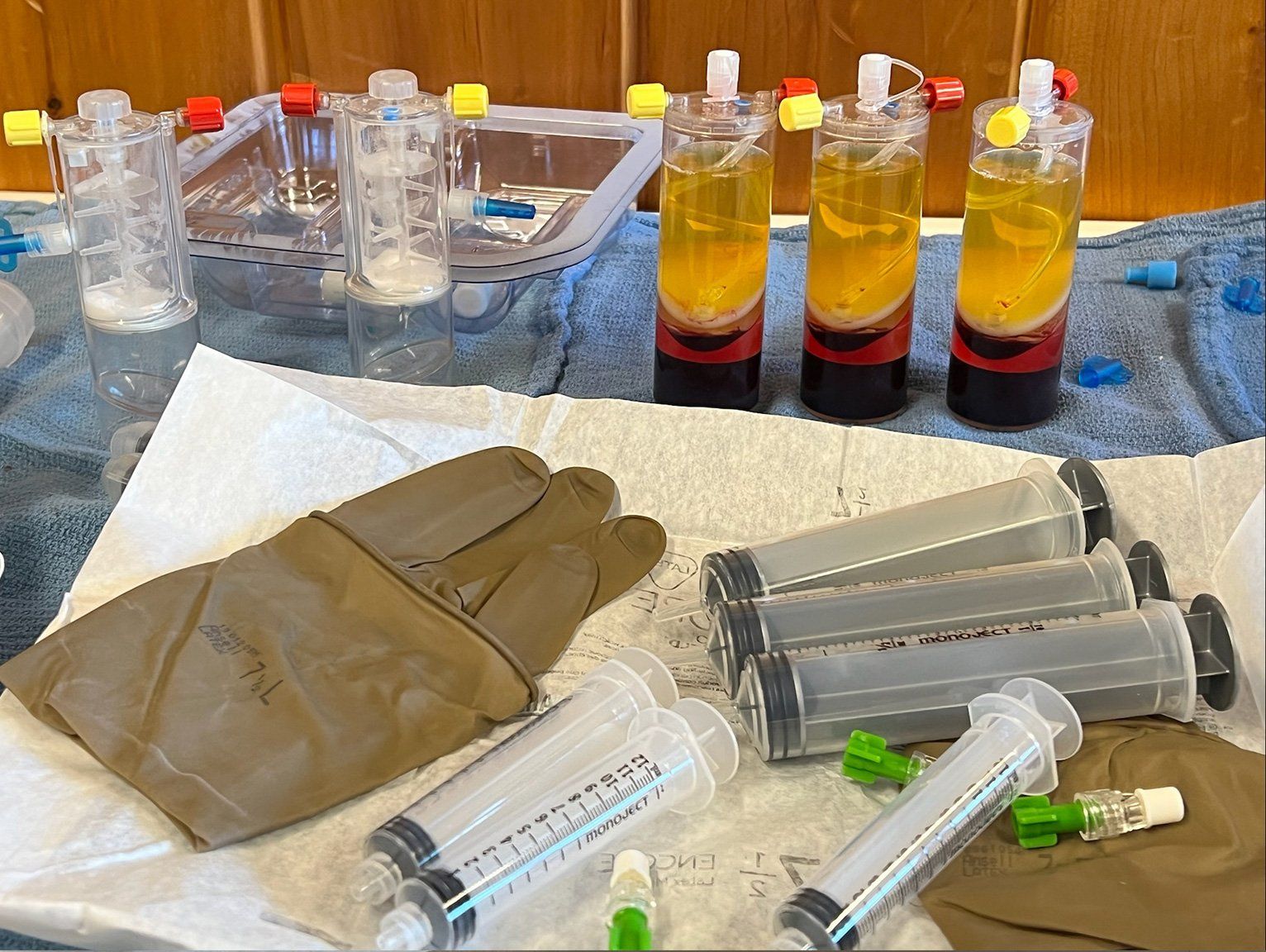 Regenerative Joint Treatments