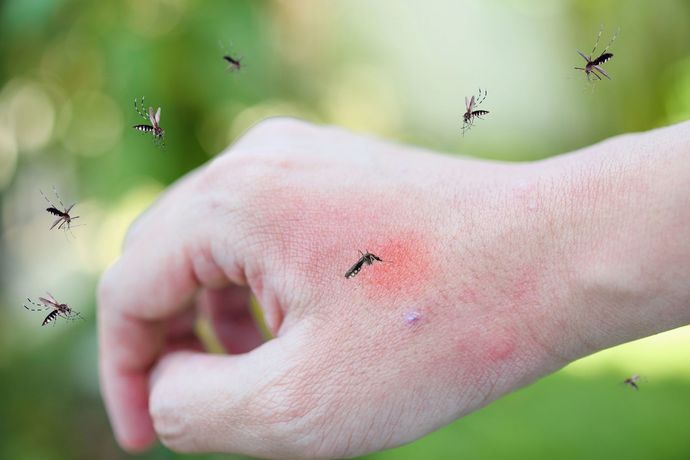Mano con punture di zanzara circondata da zanzare su uno sfondo verde sfocato.