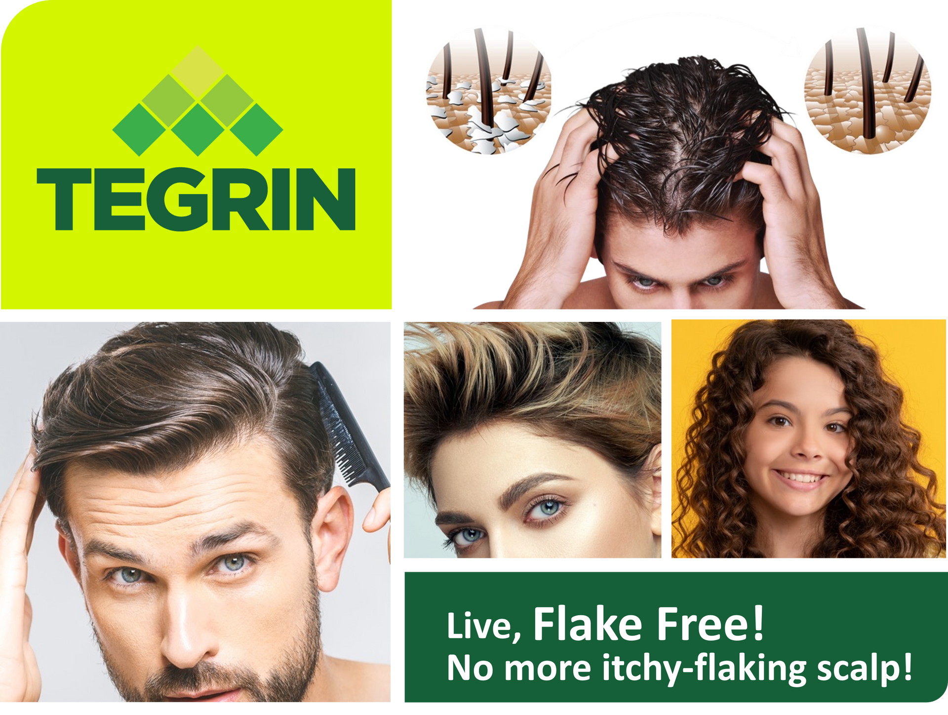 TEGRIN scalp shampoo ad with smiling models and text: “Live, Flake Free! No more itchy-flaking scalp!”