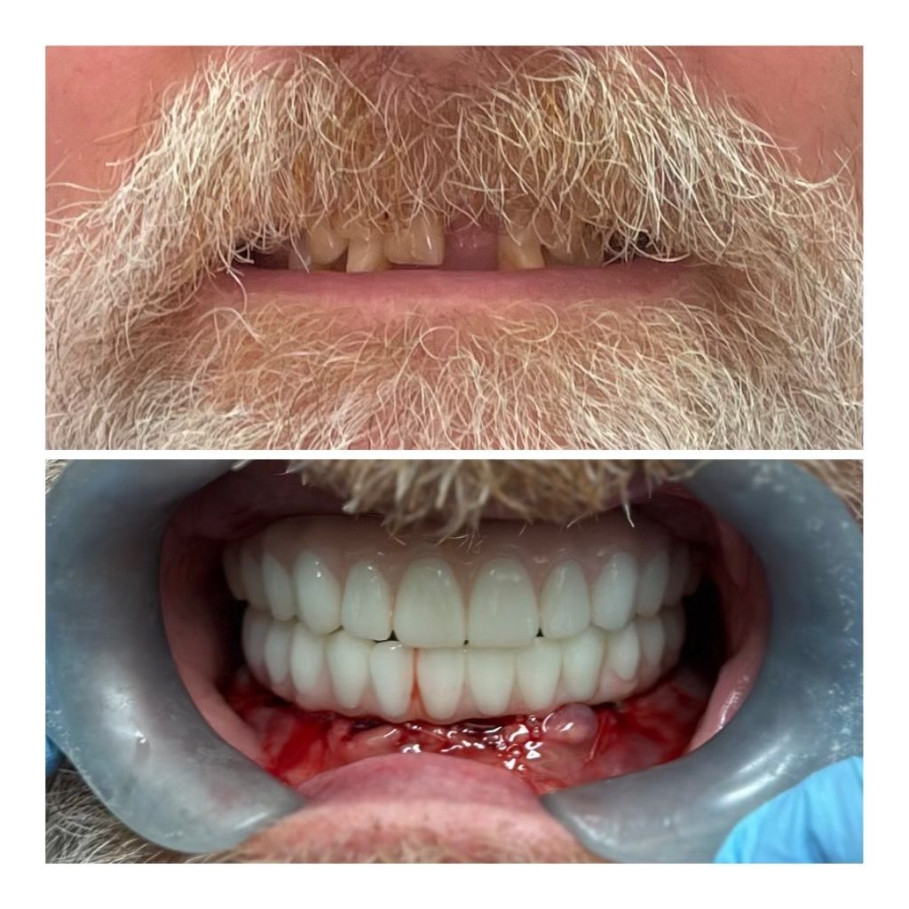 before and afters
