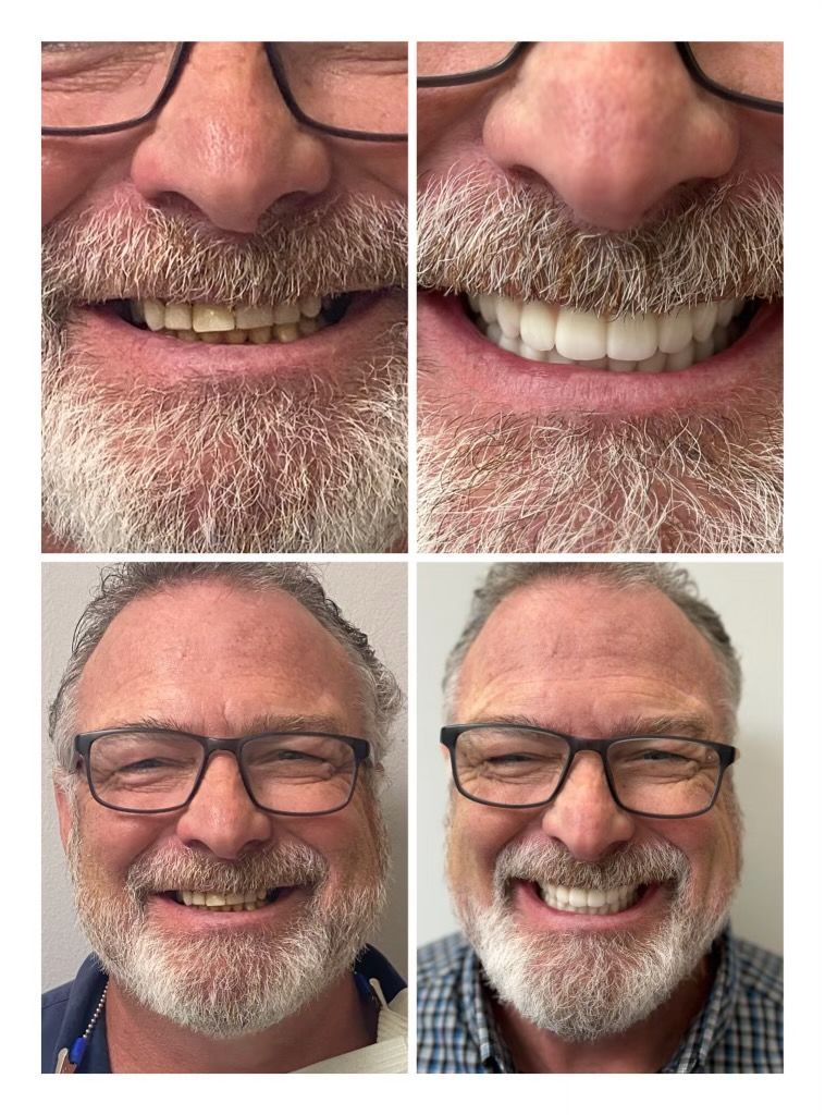 before and afters