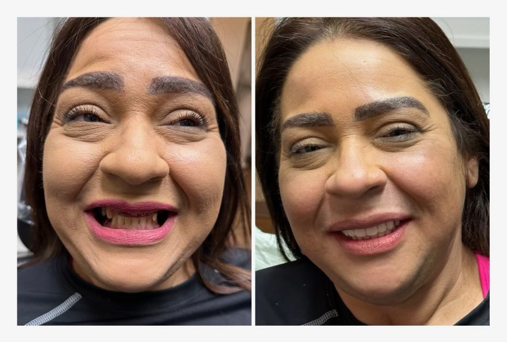 before and afters