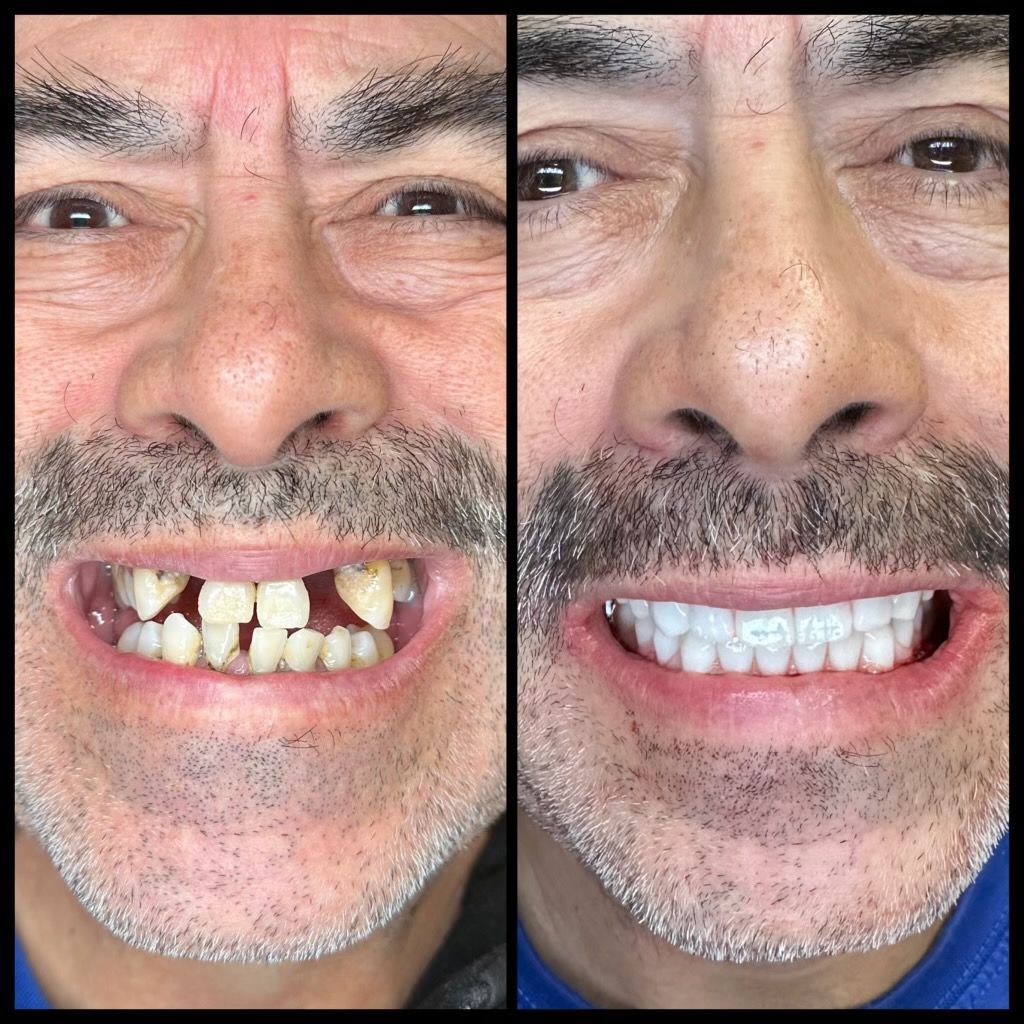 before and afters