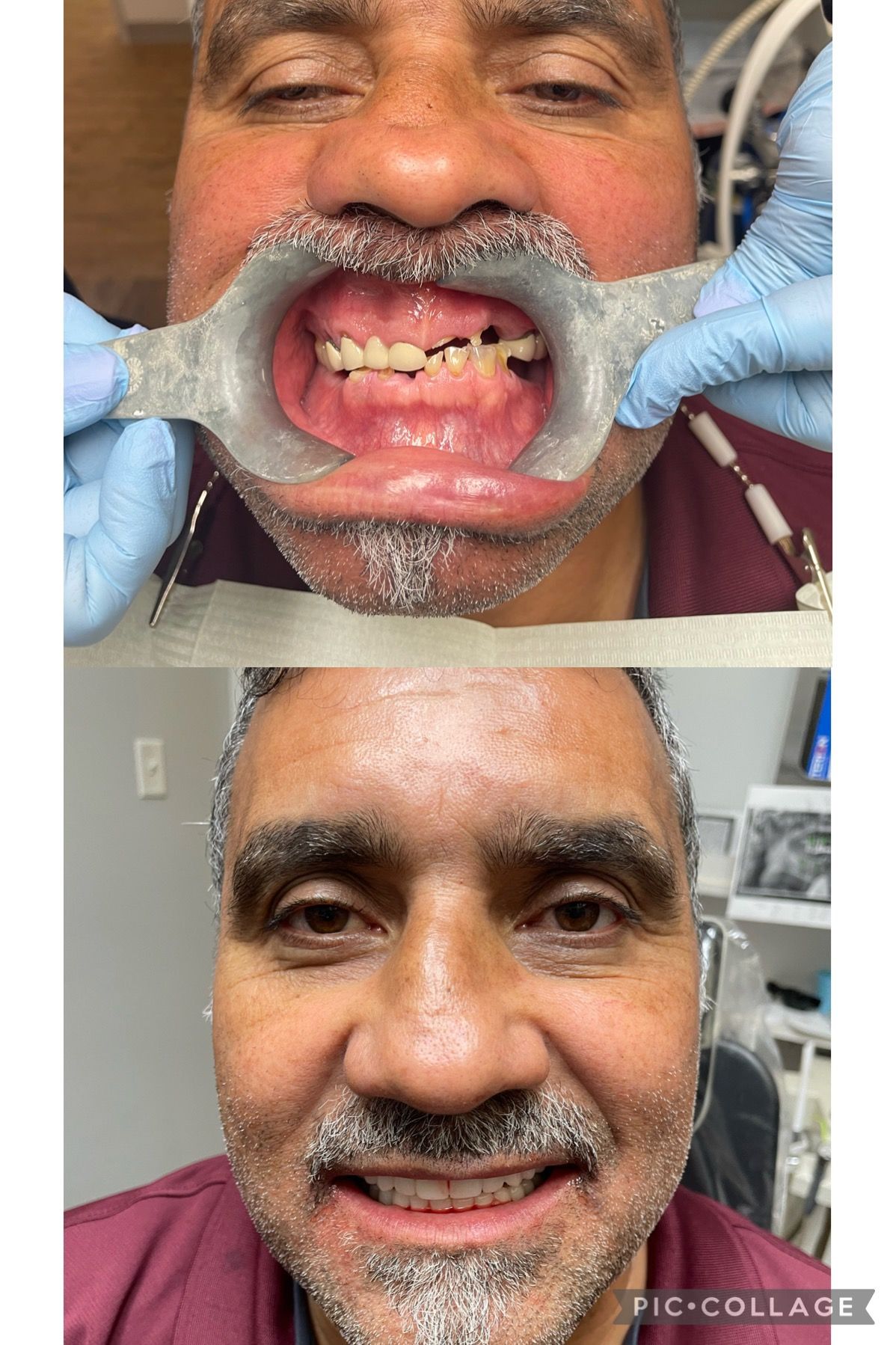 before and afters
