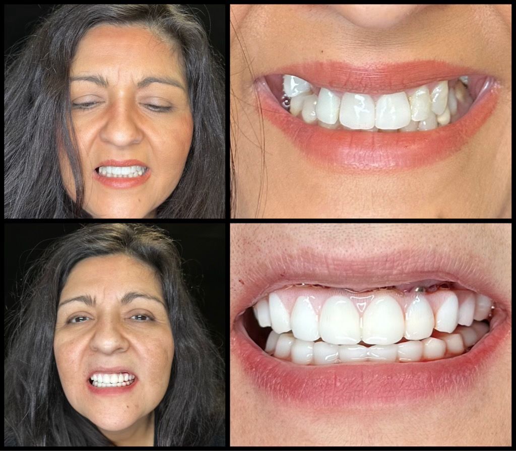before and afters