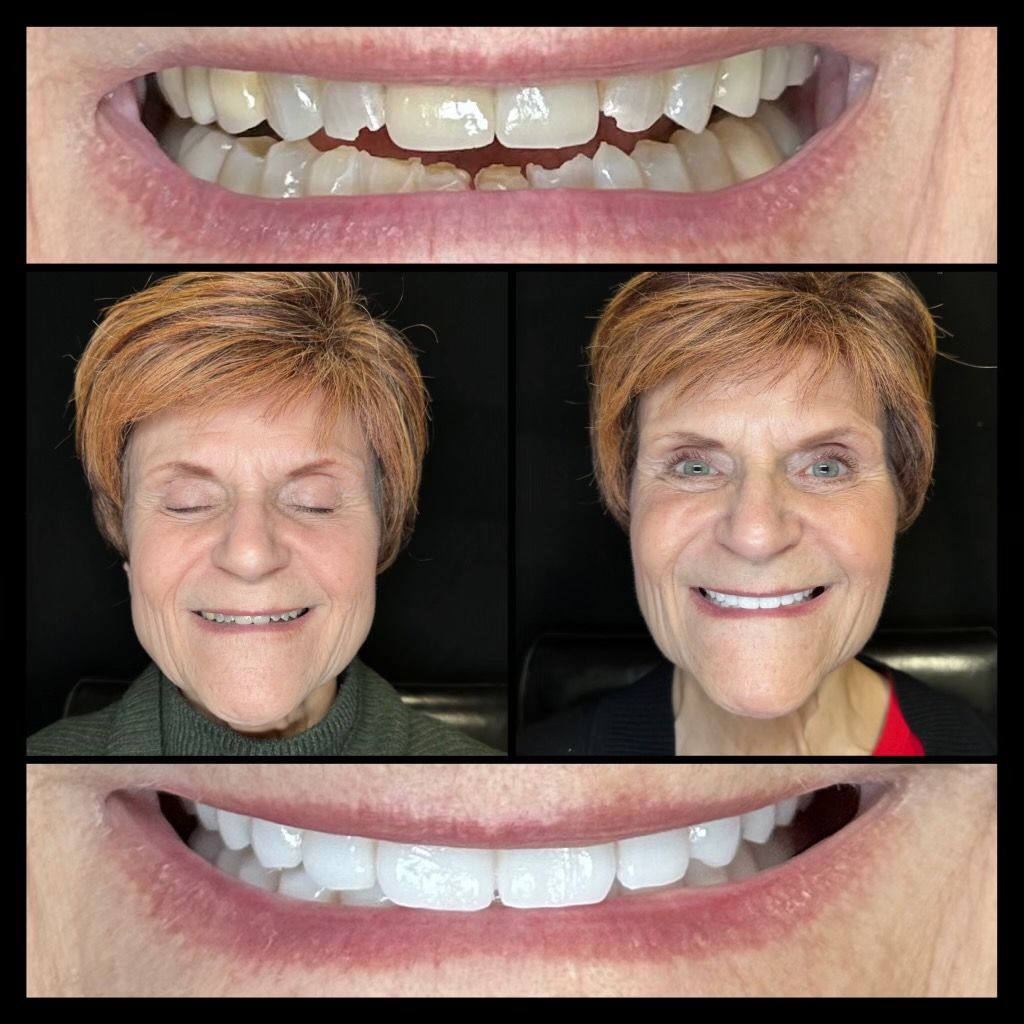before and afters