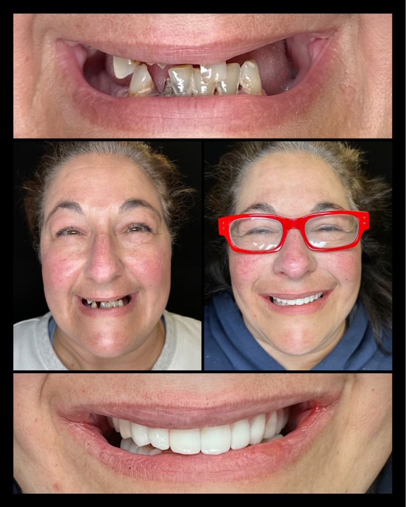 before and afters