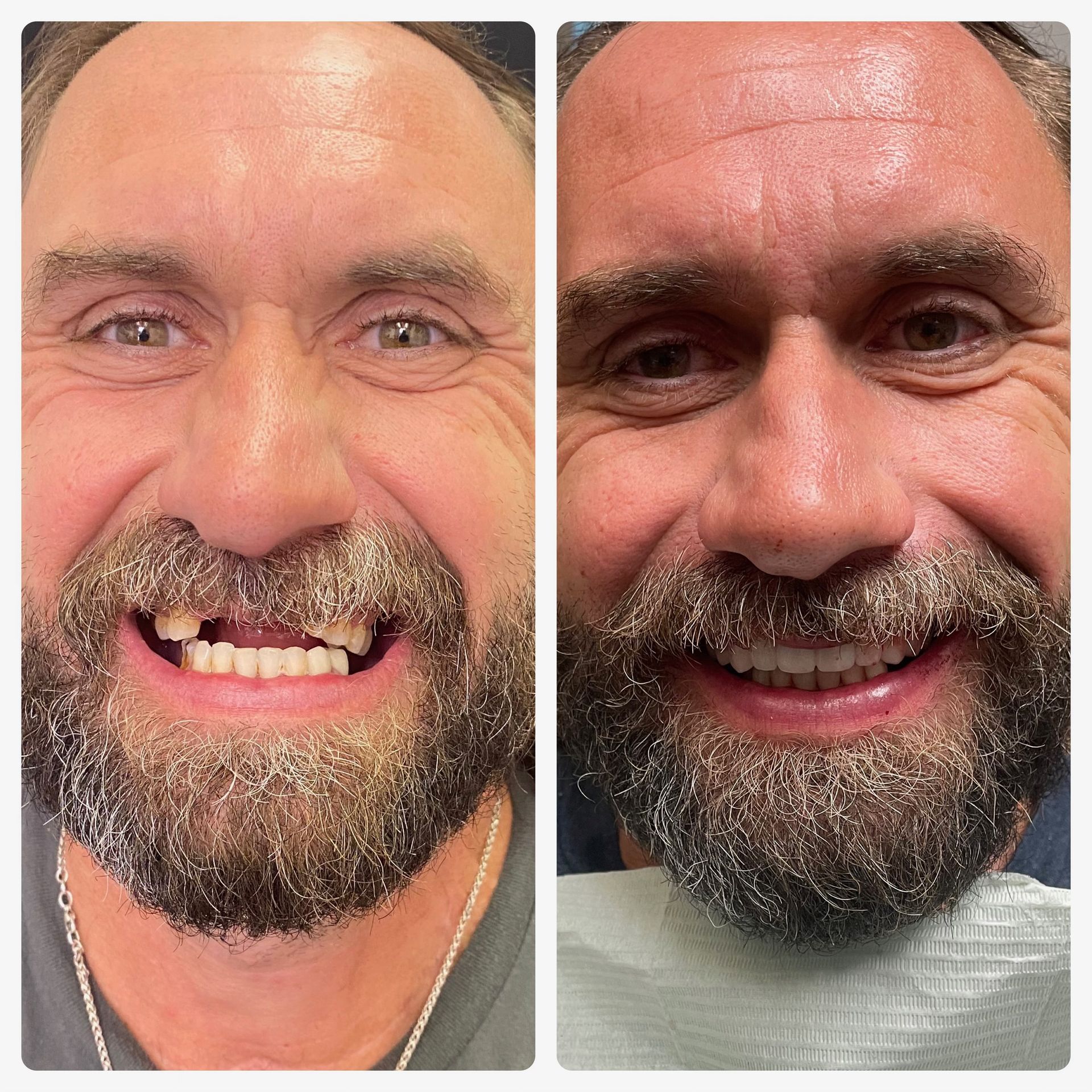 before and afters