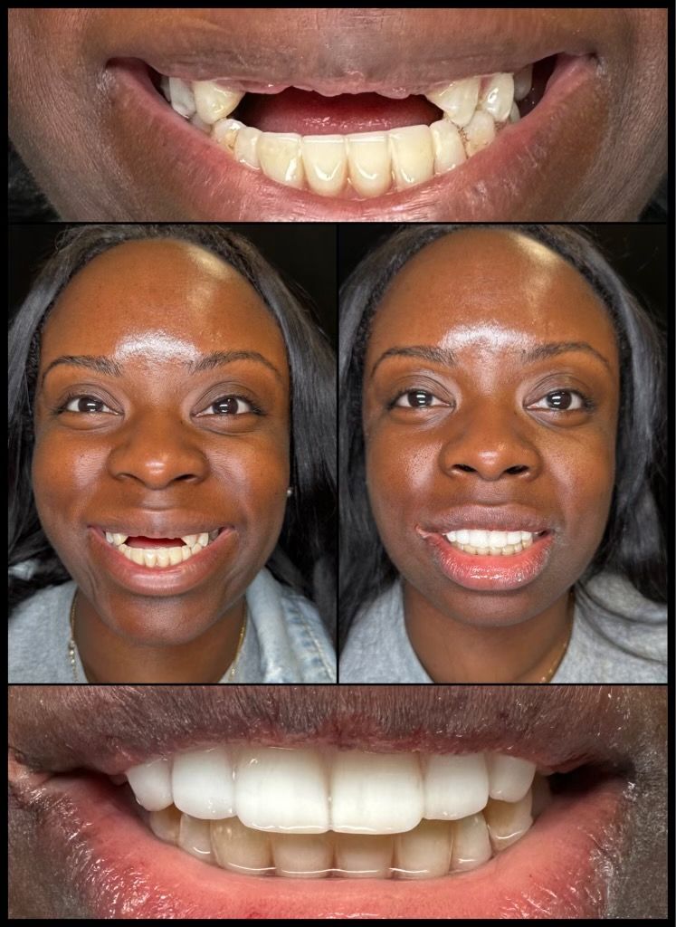 before and afters